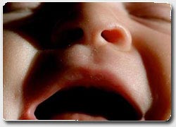 рання діагностика по крику немовляти
